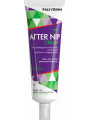 Frezyderm Crilen After Nip 30ml